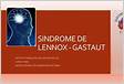 Síndrome de Lennox-Gastaut o que é, sintomas, causas e
